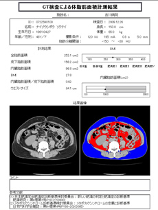 内臓脂肪測定